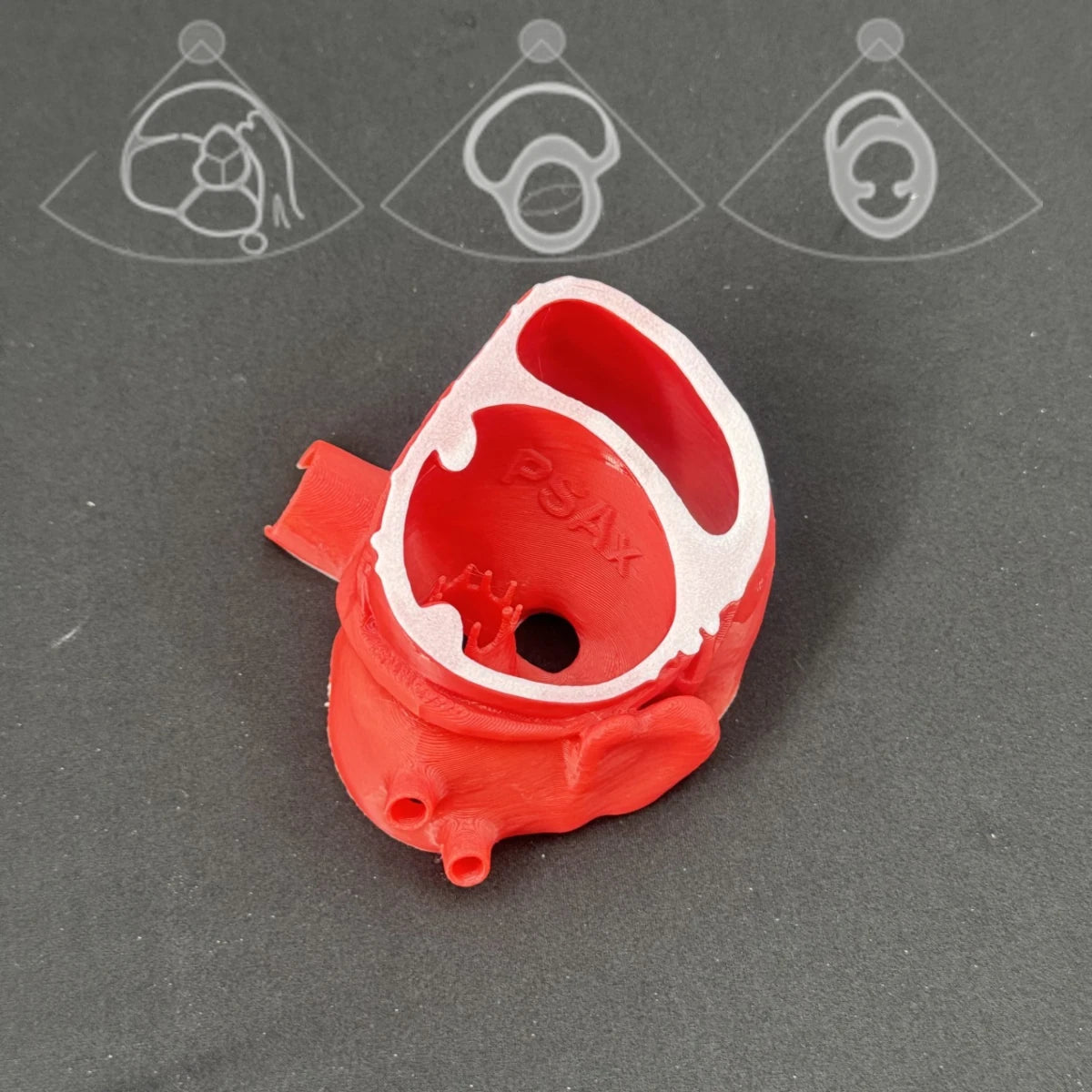 Echocardiogram View Models