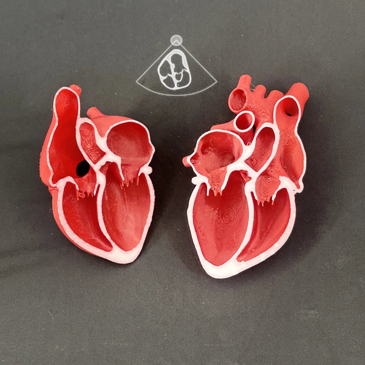 Echocardiogram View Models