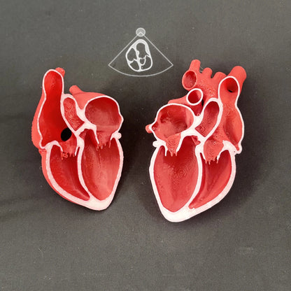 Echocardiogram View Models